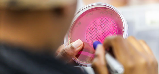 Eine Wissenschaftlerin untersucht Bakterien in einer Petrischale.