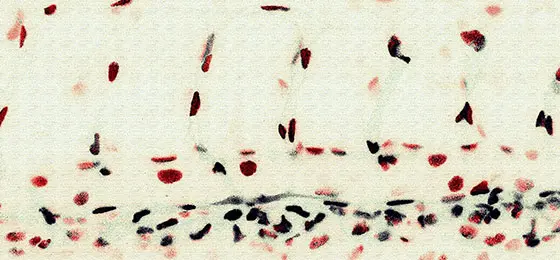 Dieses Bild zeigt ein Gewinner-Bild