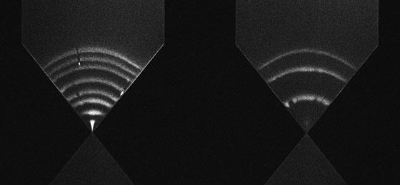 The picture shows a chip for genetic analysis.