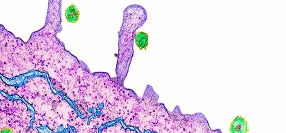 Hepatitis C viruses, TEM