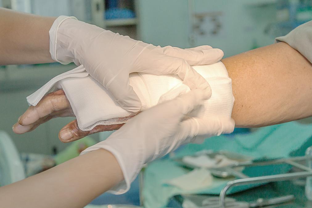 Increased susceptibility in women with burns