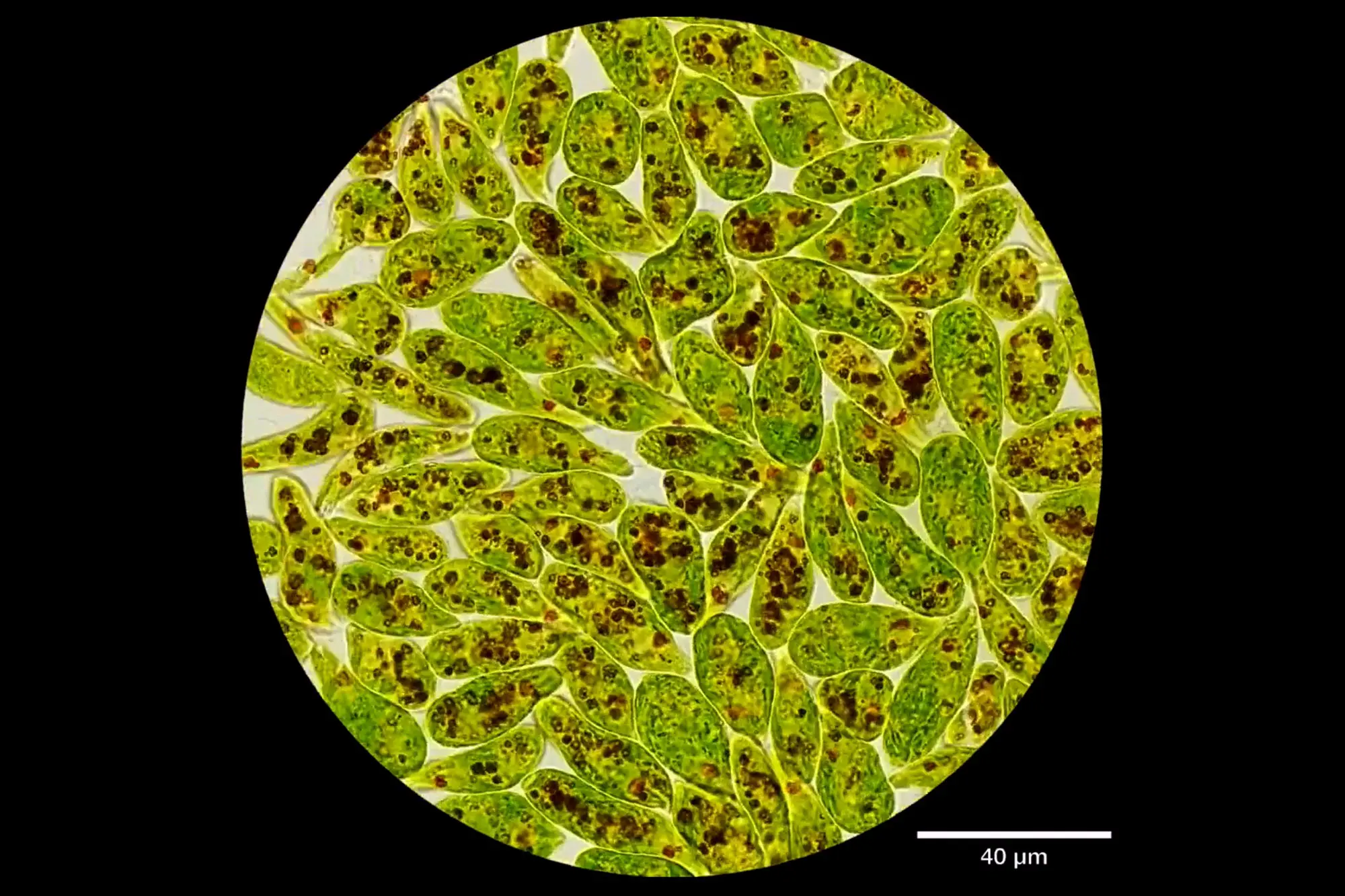 Mikroskopisches Gedränge, von Inés Segovia Campos