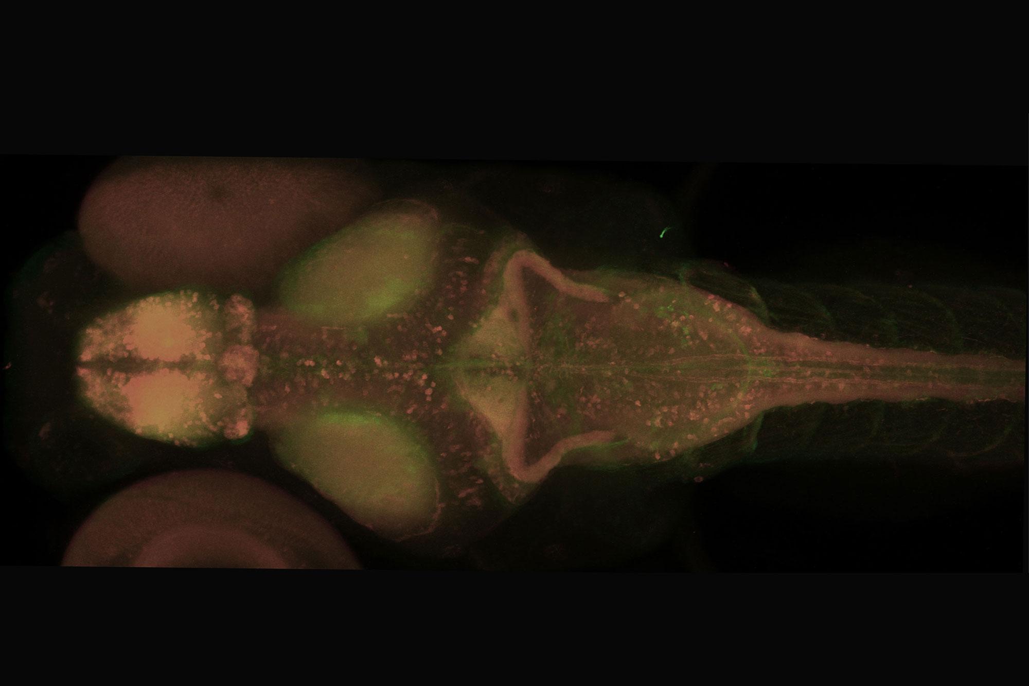 Die aktiven Hirnareale der Zebrafischlarve leuchten auf.
