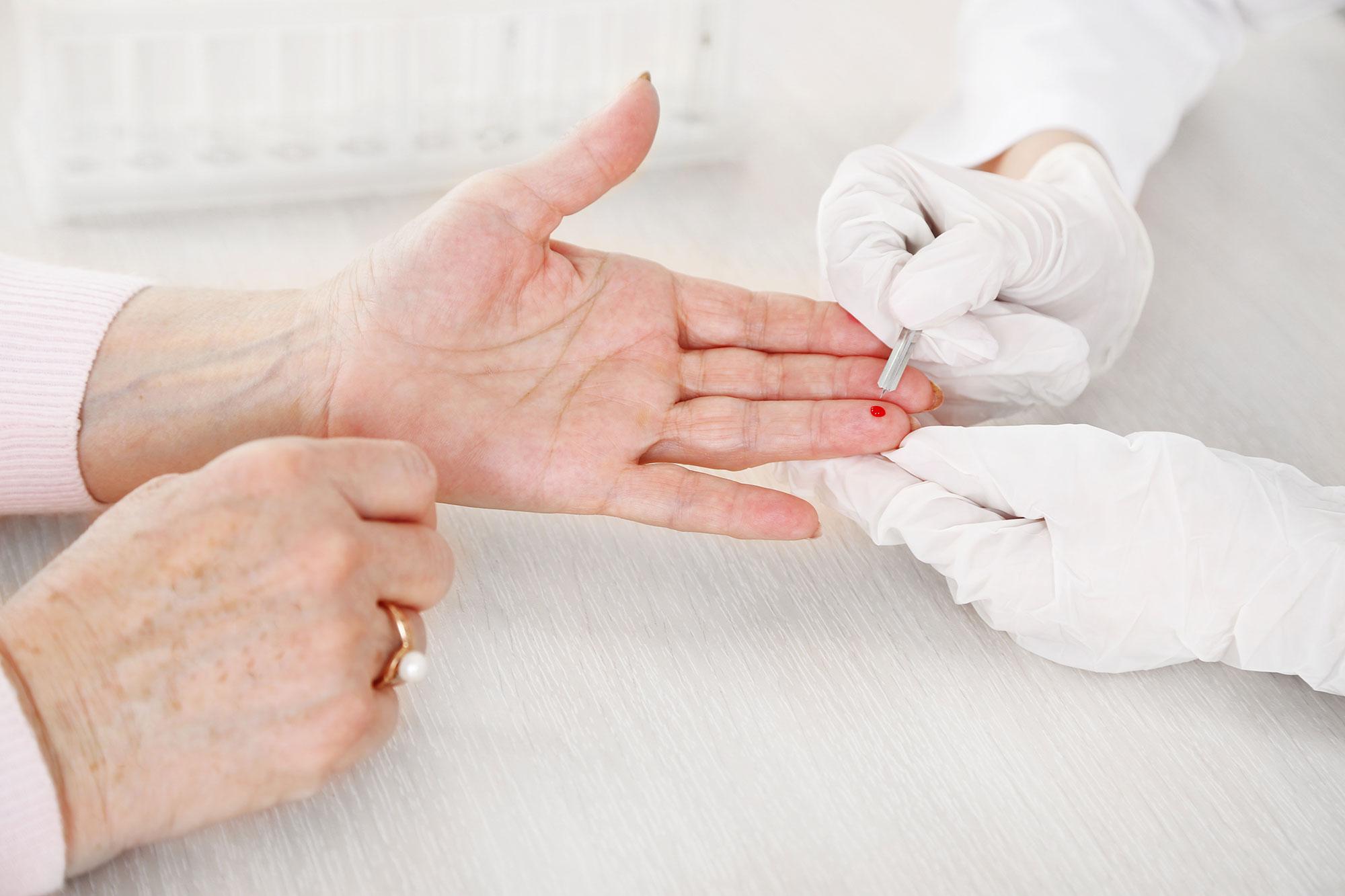 Wird benötigt für Barrierefreiheit: «Dieses Bild zeigt die Entnahme von Blut aus der Fingerkuppe.»