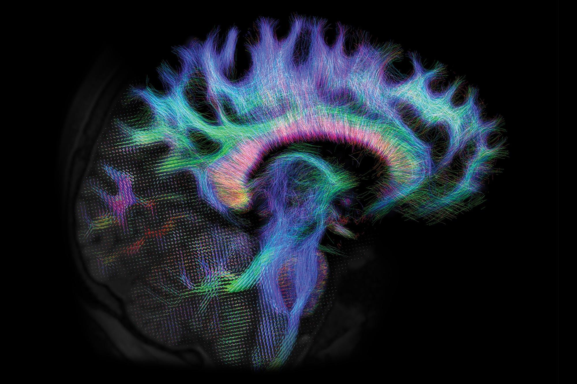 Visualisierung des Gehin