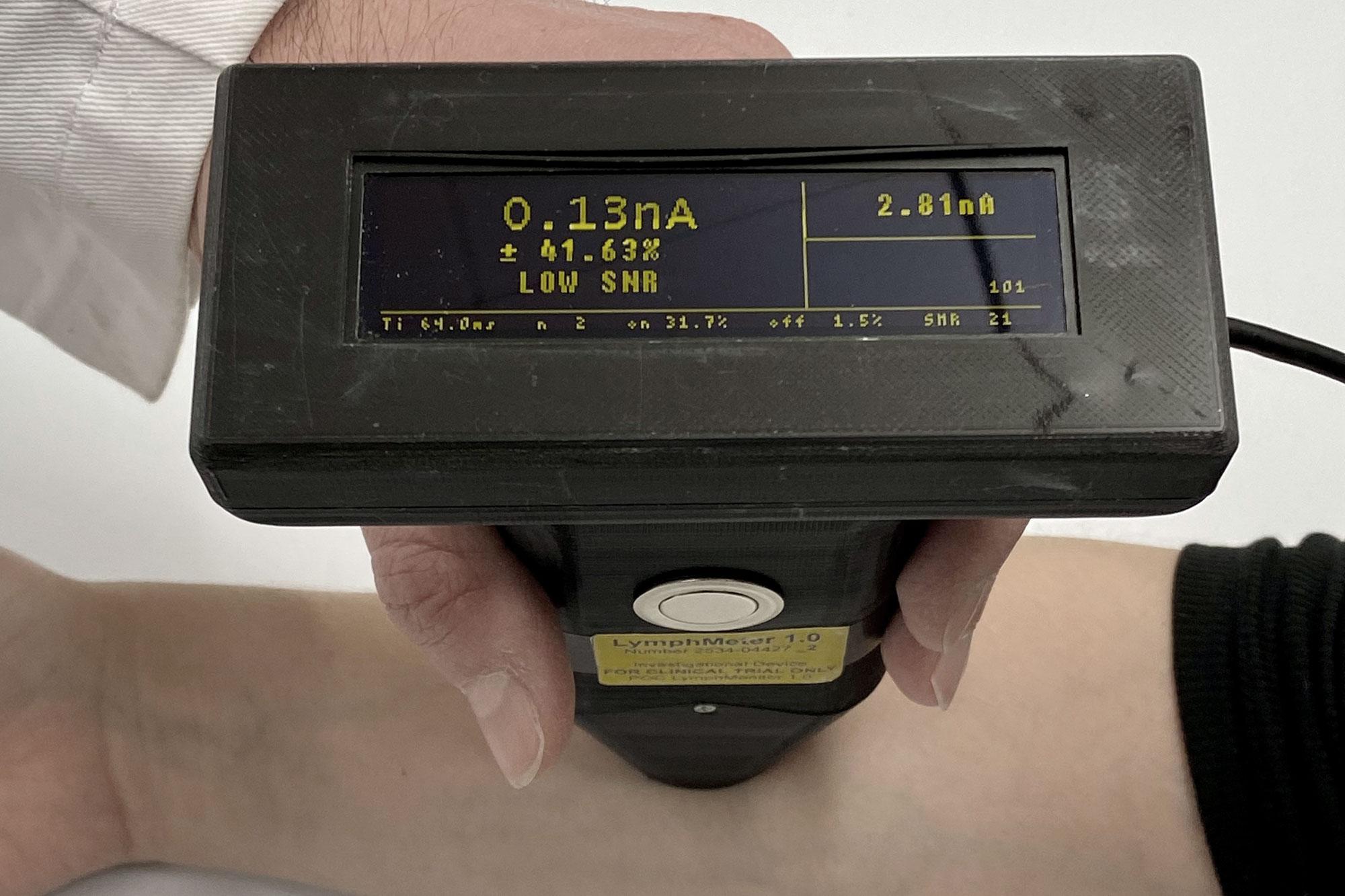 Fluoreszenzmessung am Menschen mit dem Lymphmeter.
