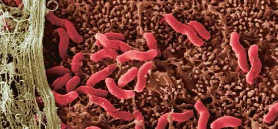 Mikrobe Helicobacter pylori © Keystone/Science Photo Library/Eye of Science